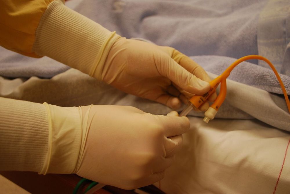 DefenCath, CorMedix’s first commercial product, is an antimicrobial drug designed to reduce catheter-related bloodstream infections in patients with kidney disease.