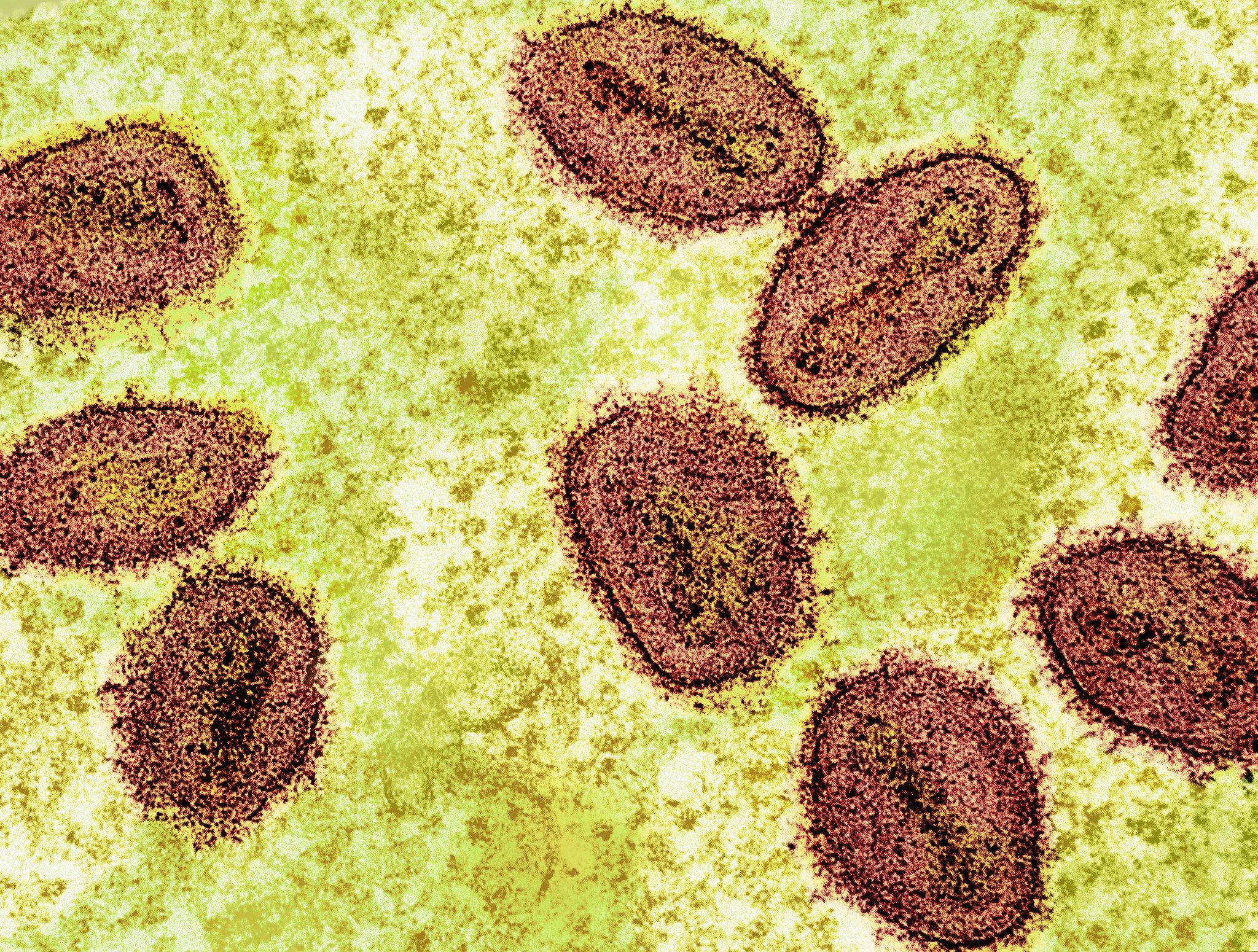 CEO Joe Papa said the expanded indication for the vaccine comes at a critical time.