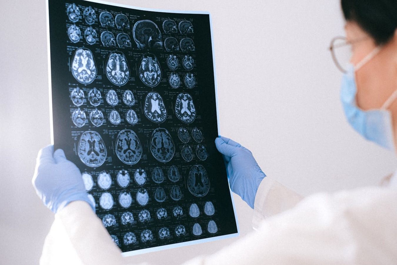 Anavex plans to file regulatory application for its Alzheimer's drug candidate in Europe.